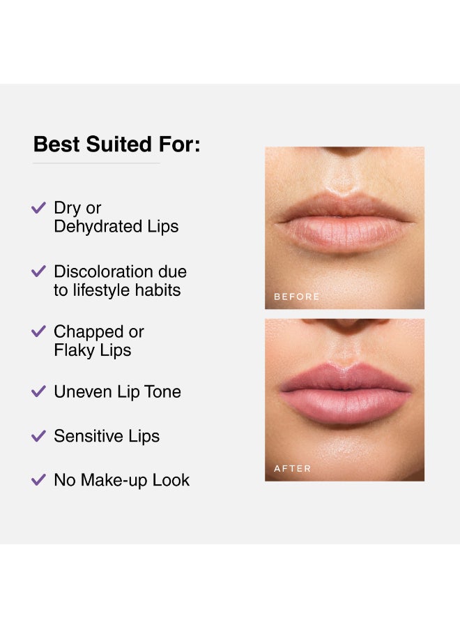 Cureskin Tinted Lip Balm For Women And Men |Hydrates & Protects For Lip Tint With Beetroot,Carrot & Strawberry |Lip Lightening Balm For Dark Lips |Tinted Lip Balm For Dark Lips To Lighten,1 Count - Image 4
